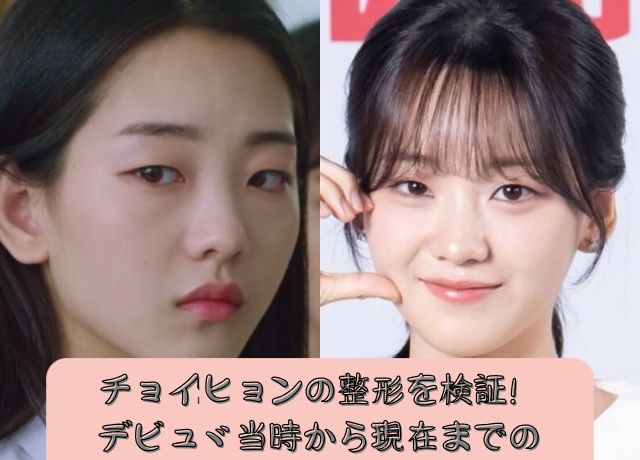 チョイヒョンの整形を検証！デビュー当時から現在までの顔の変化は