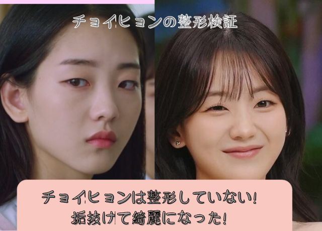 チョイヒョンの整形についての調査結果