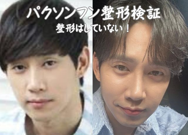 パクソンフンの整形について検証