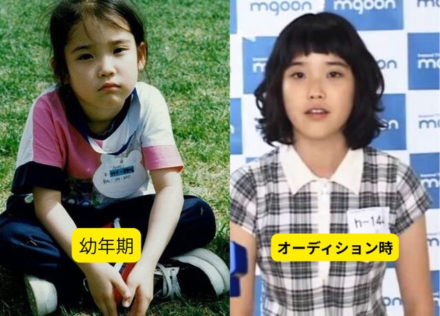 IUの整形検証