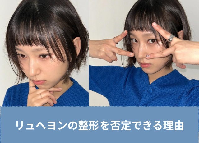 リュヘヨンの整形を否定できる理由5選