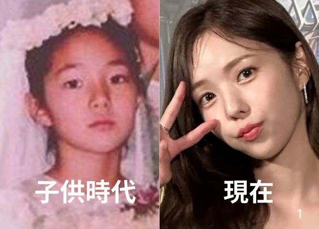 チェスビンの子供時代と現在を比較