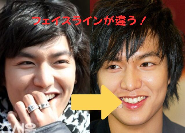 イミンホが顔がでかいのはなぜ?