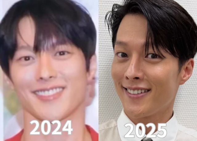 チャンギヨン整形検証画像