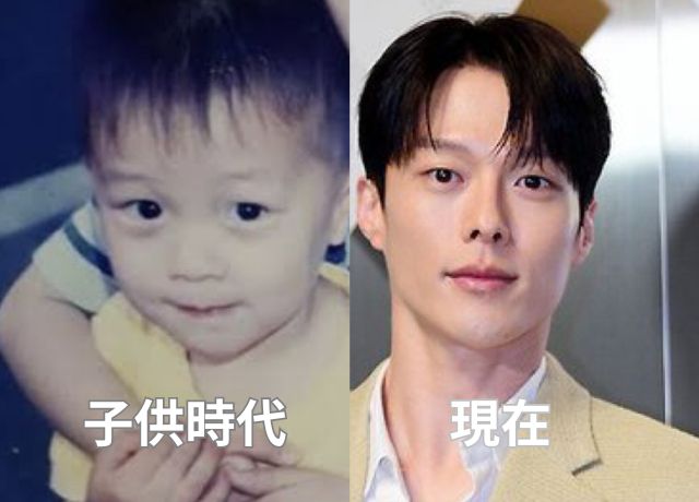 チャンギヨン整形検証画像