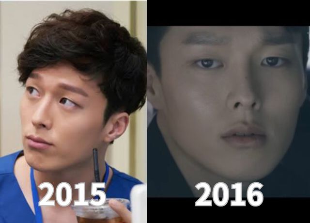 チャンギヨン整形検証画像