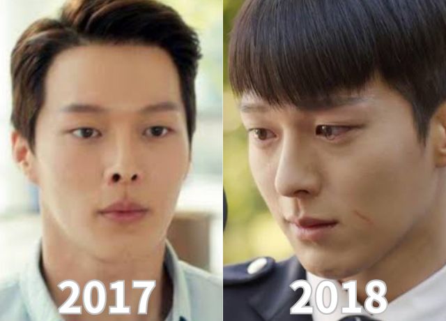 チャンギヨン整形検証画像