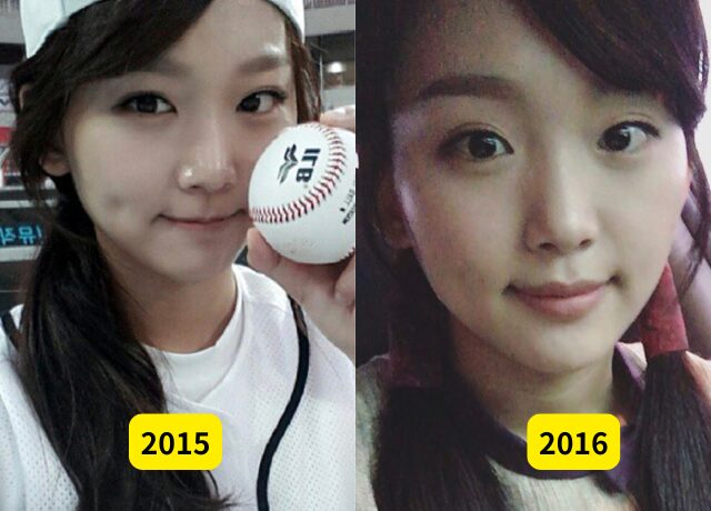 チンギジュの整形検証画像