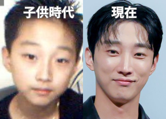 ジニョン(B1A4)の整形検証画像