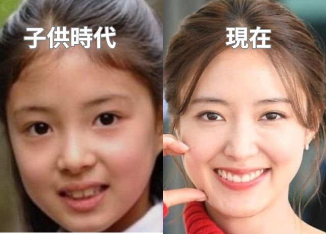 イセヨンの整形検証画像