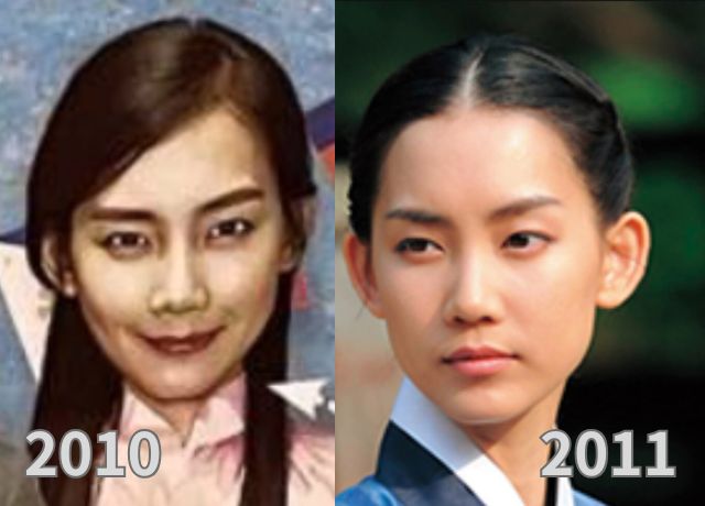 シンヒョンビンの整形検証画像