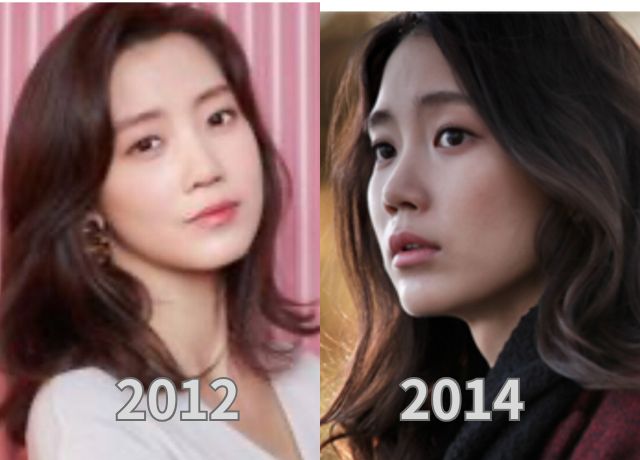 シンヒョンビンの整形検証画像