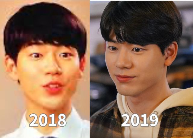 ペヒョンソンの整形検証画像