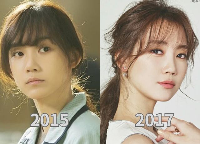 シンヒョンビンの整形検証画像