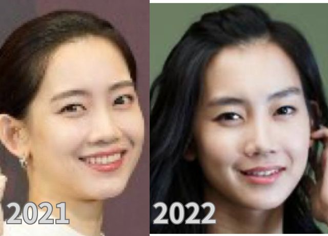 シンヒョンビンの整形検証画像