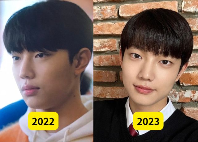 チョジュニョンの整形検証画像