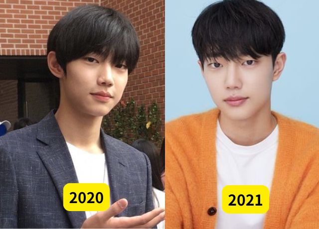 チョジュニョンの整形検証画像