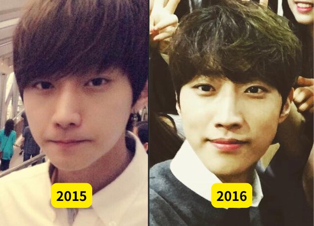 ジニョン(B1A4)の整形検証画像