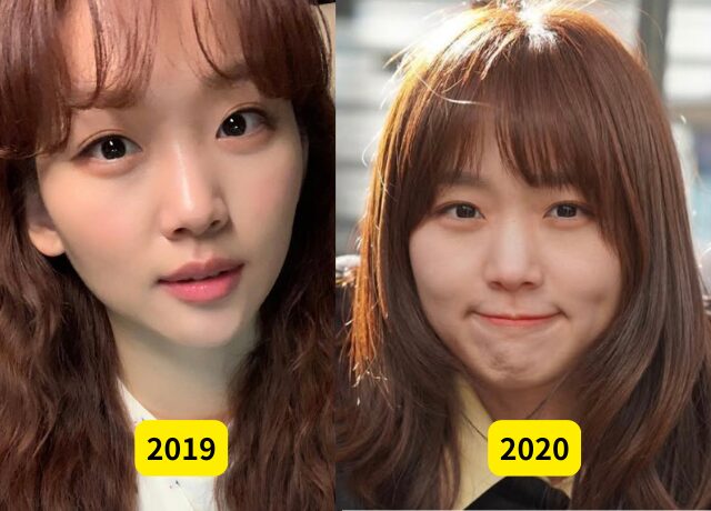 チンギジュの整形検証画像