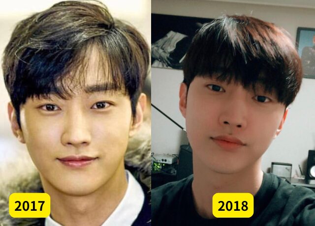 ジニョン(B1A4)の整形検証画像