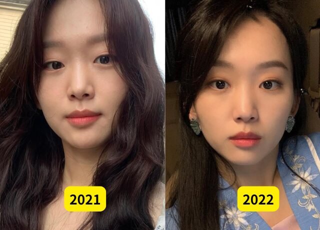 チンギジュの整形検証画像