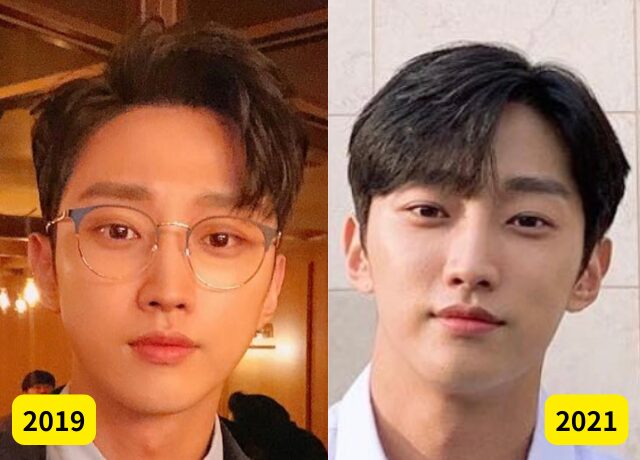 ジニョン(B1A4)の整形検証画像