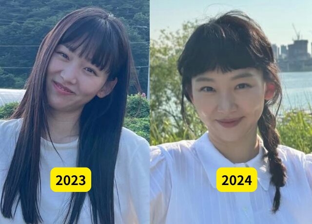 チンギジュの整形検証画像