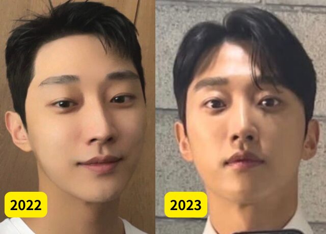 ジニョン(B1A4)の整形検証画像