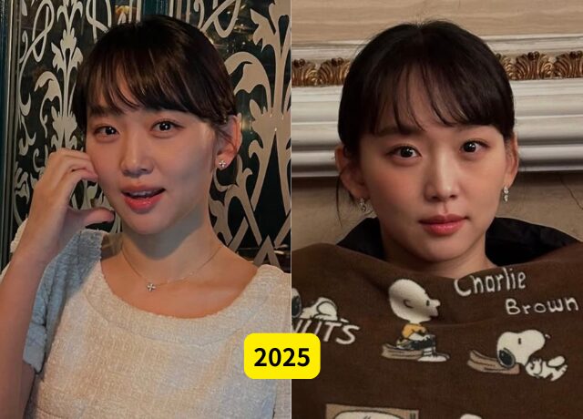 チンギジュの整形検証画像