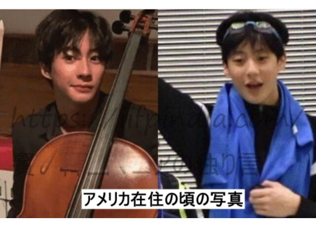 RIIZEアントン整形検証画像