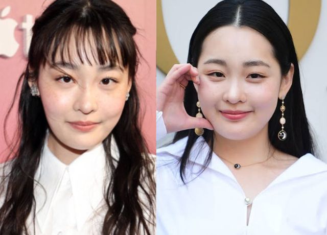 キムミンハのそばかす画像