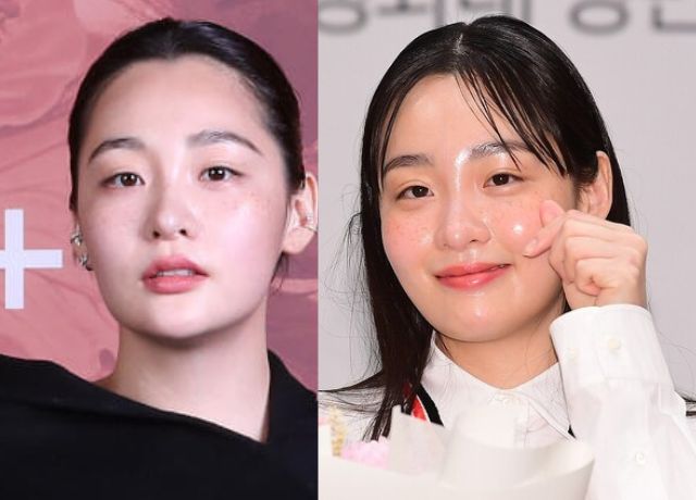 キムミンハのそばかす画像